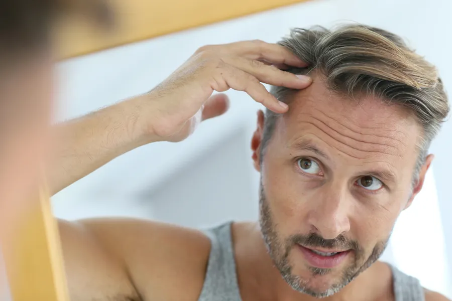Peptides-for-Hair-Restoration-Doctor A middle-aged man with blonde and gray hair inspects his receding hairline in the mirror, considering getting peptides for hair restoration treatments from David Garcia, D.O. in Nashville Metro.