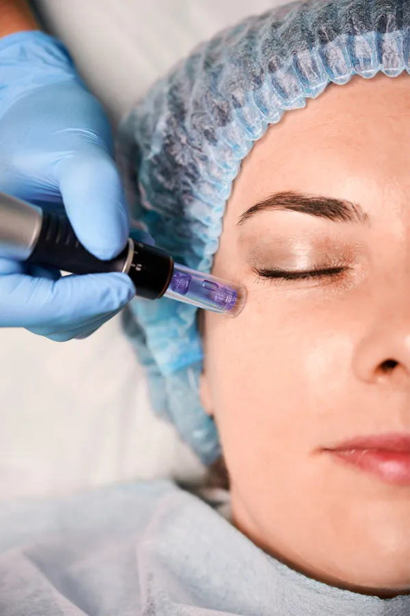 Peptides-for-Skin-and-Aesthetics-Treatment A woman receiving peptide therapy to her face. Get peptides for Skin and Aesthetics from David Garcia, D.O. in Nashville Metro.