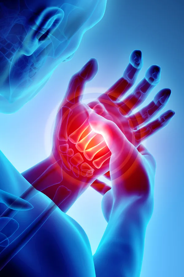 Stem-Cells-for-joint-Pain-Treatment 3D illustration of a man's x-ray holding his hand in pain. Get stem cells for joint pain from David Garcia, D.O. in Nashville Metro.