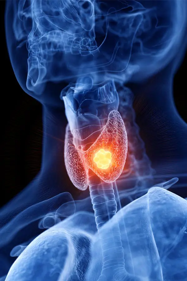 Thyroid-Imbalance-Treatment A 3D illustration of an x-ray of a human neck, highlighting the thyroid. Get help with thyroid imbalance from David Garcia, D.O. in Nashville Metro.